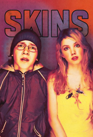 Skins – Hautnah (2007)