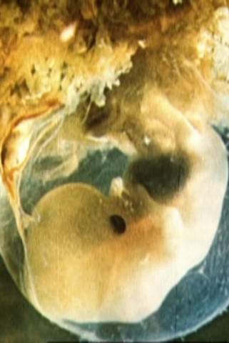 Schwangerschaft und Geburt (1982)