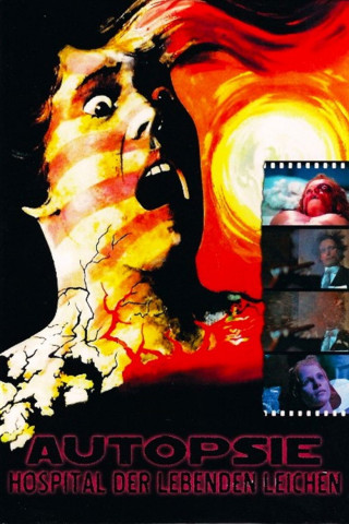 Autopsie - Hospital der lebenden Leichen (1975)